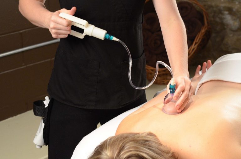 cupping-2852483_1280