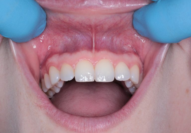 mouth-5671265_1920