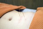 Acupuncture May Increase Fertility! Check Out These Benefits