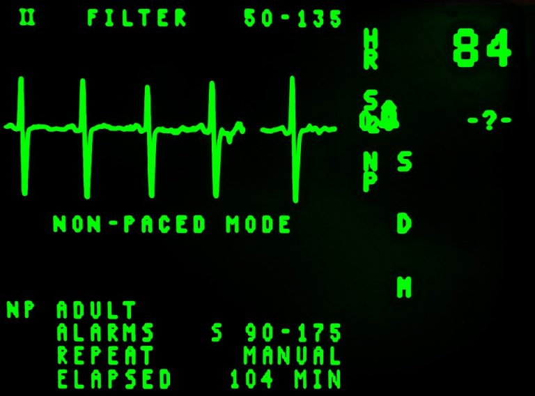 electrocardiogram-16948_960_720