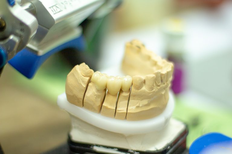 dentures-3532981_1920