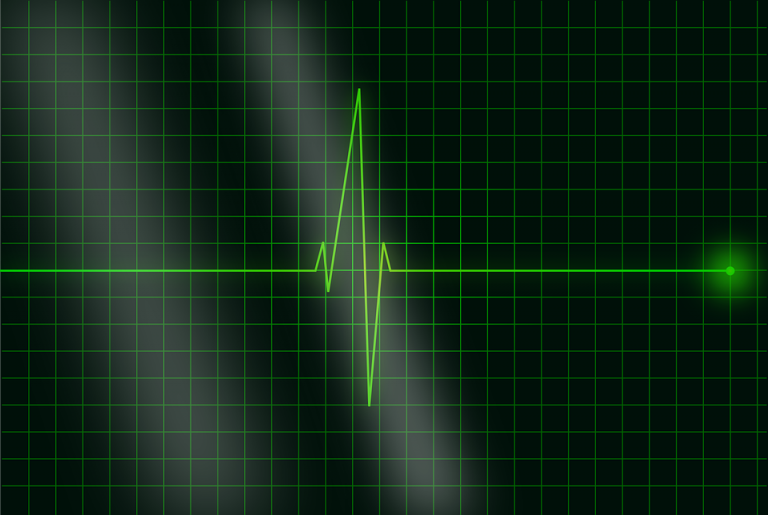 electrocardiogram-36732_960_720