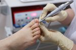 Tips For Finding The Best Podiatrist Marietta GA