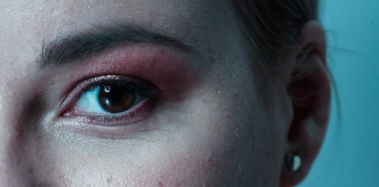 eye-4680194_960_720