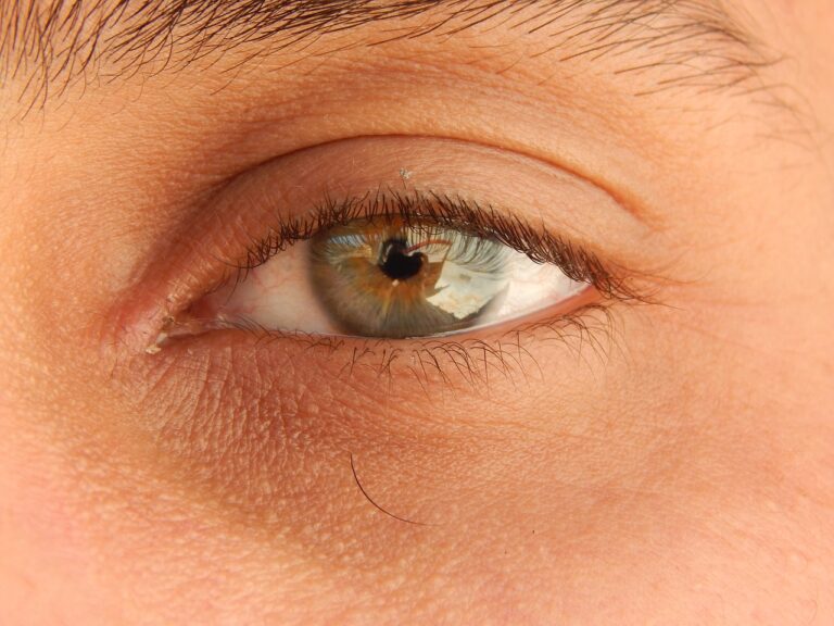 eye-5531078_1280