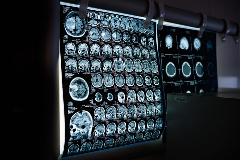 x-ray-6841384_1280